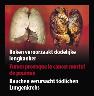 Belgium 2007 Health Effects lung - diseased organ, lung cancer, gross